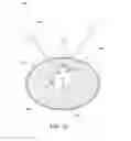 Fig. 13 - Removable deployment device, system, and method for implantable prostheses