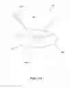 Fig. 14 - Removable deployment device, system, and method for implantable prostheses