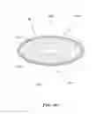 Fig. 16 - Removable deployment device, system, and method for implantable prostheses