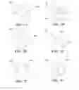Fig. 17 - Removable deployment device, system, and method for implantable prostheses