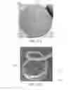 Fig. 37 - Removable deployment device, system, and method for implantable prostheses