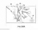 Fig. 42 - Removable deployment device, system, and method for implantable prostheses