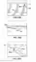 Fig. 43 - Removable deployment device, system, and method for implantable prostheses