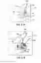 Fig. 48 - Removable deployment device, system, and method for implantable prostheses