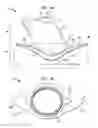 Fig. 02 - Implantable flow connector