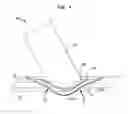 Fig. 10 - Implantable flow connector