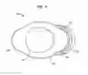 Fig. 12 - Implantable flow connector
