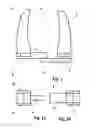 Fig. 02 - Surgical clip and device for applying the clip
