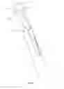 Fig. 07 - Cutting device for endovascular surgery