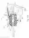 Fig. 15 - Features for coupling surgical instrument shaft assembly with instrument body