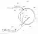 Fig. 01 - Pressure-sensing vitrectomy surgical systems and methods