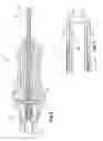 Fig. 03 - Pressure-sensing vitrectomy surgical systems and methods