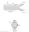 Fig. 04 - Systems and Methods for a Surgical Tissue Manipulator