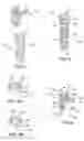 Fig. 03 - Spinal stabilization systems and methods