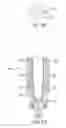 Fig. 19 - Spinal stabilization systems and methods