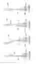 Fig. 41 - Spinal stabilization systems and methods