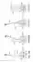 Fig. 43 - Spinal stabilization systems and methods