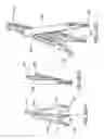 Fig. 50 - Spinal stabilization systems and methods