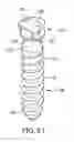 Fig. 51 - Spinal stabilization systems and methods