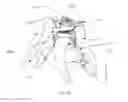 Fig. 03 - Cervical spinous process staple