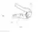 Fig. 04 - Cervical spinous process staple