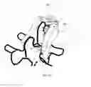 Fig. 07 - Cervical spinous process staple