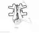 Fig. 09 - Cervical spinous process staple