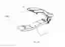 Fig. 13 - Cervical spinous process staple