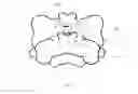 Fig. 25 - Cervical spinous process staple