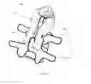 Fig. 33 - Cervical spinous process staple