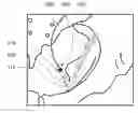 Fig. 01 - Devices, systems, and methods for acetabulum repair