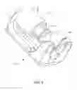 Fig. 06 - Surgical constructs and related methods of installation