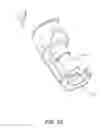 Fig. 26 - Surgical constructs and related methods of installation