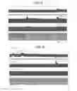 Fig. 05 - Electrical stimulation treatment of hypotension