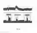 Fig. 19 - Electrical stimulation treatment of hypotension