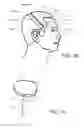 Fig. 23 - Implantable electroacupuncture system and method for treating parkinson's disease and essential tremor through application of stimului at or near an acupoint on the chorea line