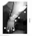 Fig. 05 - Method for functional electrical stimulation therapy