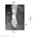 Fig. 10 - Method for functional electrical stimulation therapy