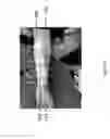 Fig. 40 - Method for functional electrical stimulation therapy