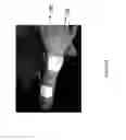 Fig. 50 - Method for functional electrical stimulation therapy