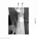 Fig. 53 - Method for functional electrical stimulation therapy