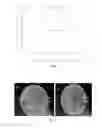 Fig. 09 - Noble metal nanoparticles, method for preparing the same and their application