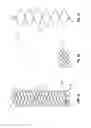 Fig. 02 - Plain woven stents