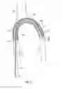 Fig. 09 - Plain woven stents