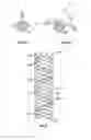 Fig. 19 - Plain woven stents