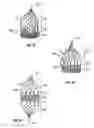 Fig. 33 - Plain woven stents