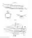 Fig. 02 - Endoprosthesis, delivery device and a method for implanting such endoprosthesis