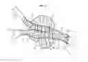 Fig. 07 - Endoprosthesis, delivery device and a method for implanting such endoprosthesis