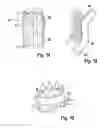 Fig. 09 - Endoprosthesis, delivery device and a method for implanting such endoprosthesis