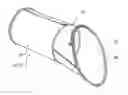 Fig. 01 - THORACIC STENT GRAFT